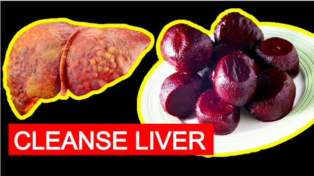 Five Powerful Foods That Can Cure a Fatty Liver