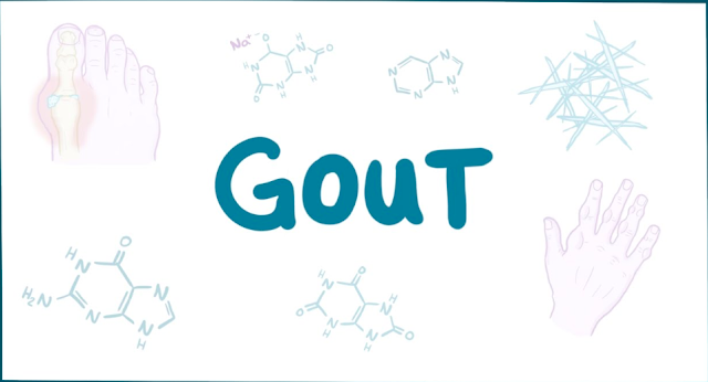 Gout-Causes, Symptoms, Diagnosis, Treatment and Pathology