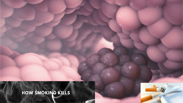 How Smoking Kills