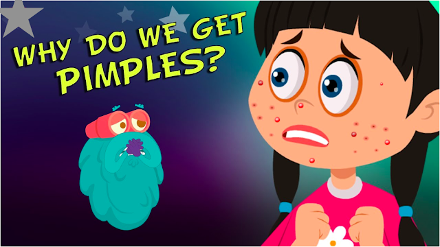 Why Do We Get Pimples